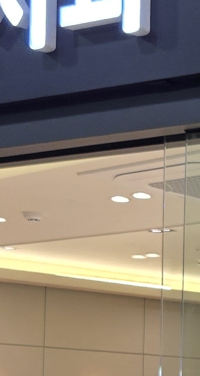 치아 발치 후 임플란트 언제부터 준비할까 관련 이미지 26