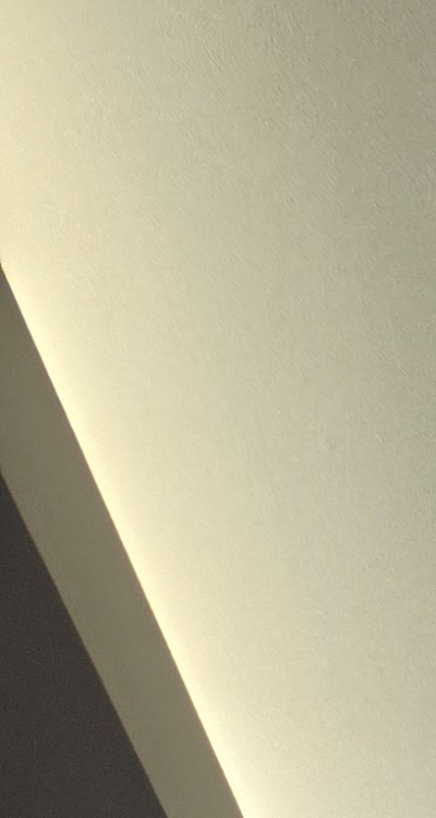 반대교합 치아교정 해결 가능할까 관련 이미지 8