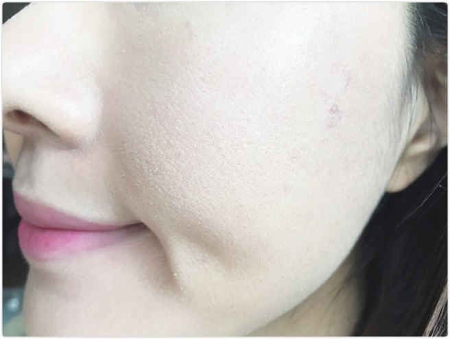 환절기 피부트러블 집에서 간편하게! 관련 이미지 6