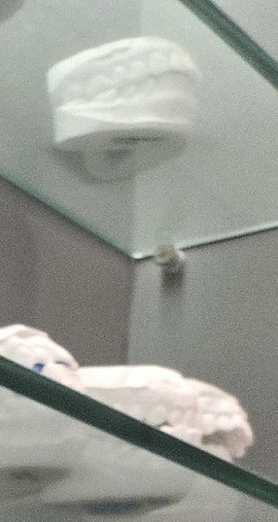 사랑니 주변 잇몸 통증 지금부터가 중요하니까 관련 이미지 20