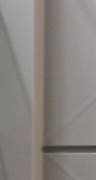 앞니 틀어짐 부분교정 얼마나 걸릴까 관련 이미지 30