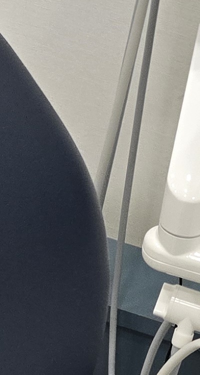 치아 사이 벌어짐 심해지는 이유부터 알아보면 관련 이미지 23