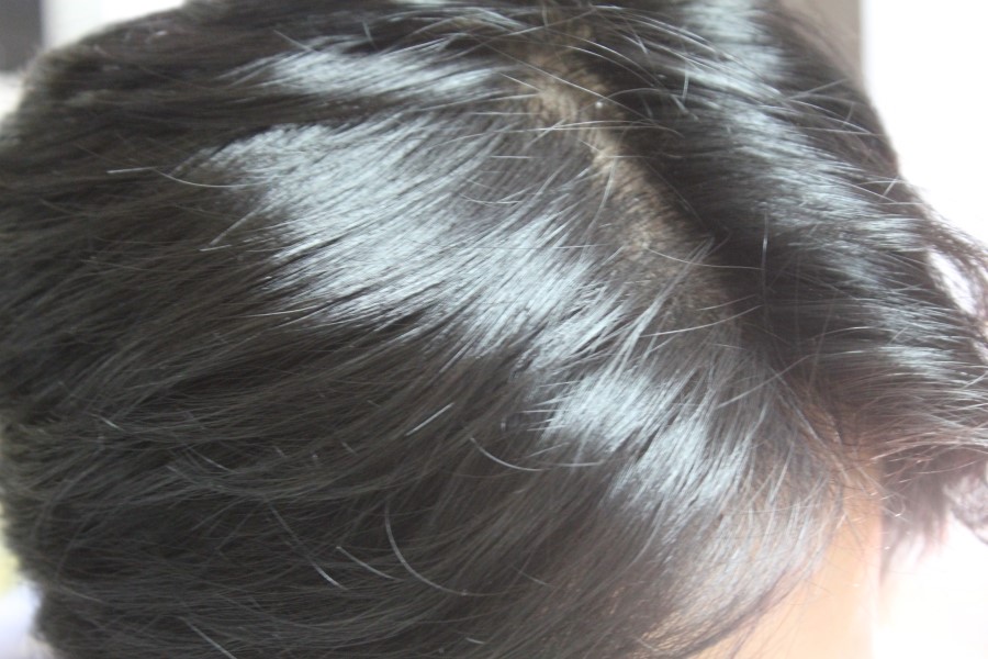 셀프헤어클리닉 이렇게 쉽게 가능해요 관련 이미지 13