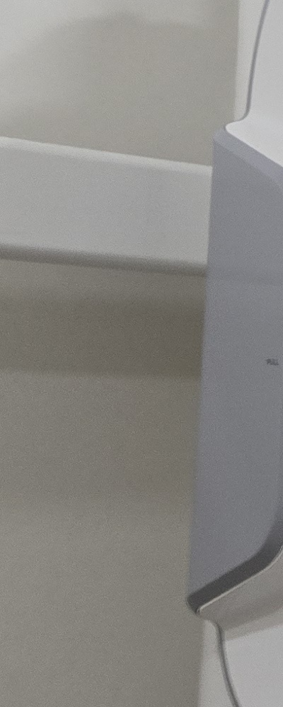 인레이 치료 후 신경치료 이유가 궁금하다면 관련 이미지 24