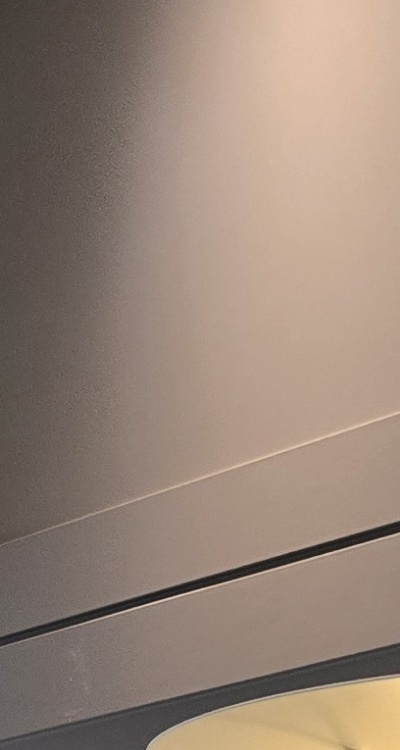 인레이 치료 후 통증 자꾸 심해지는데 괜찮은걸까 관련 이미지 27