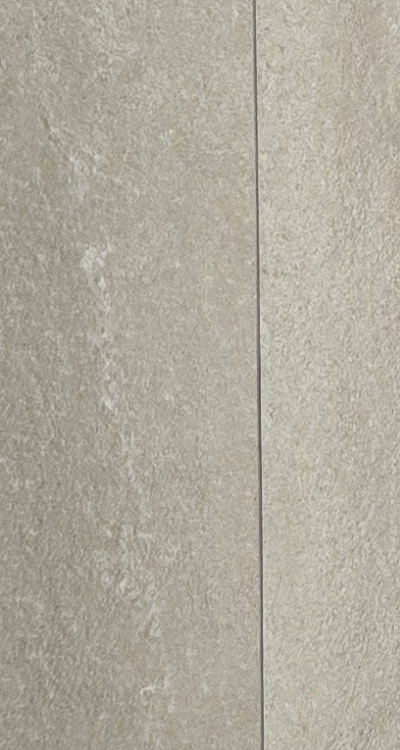 임플란트의 장점 할까 말까 고민이신 분들을 위한 정리 관련 이미지 33