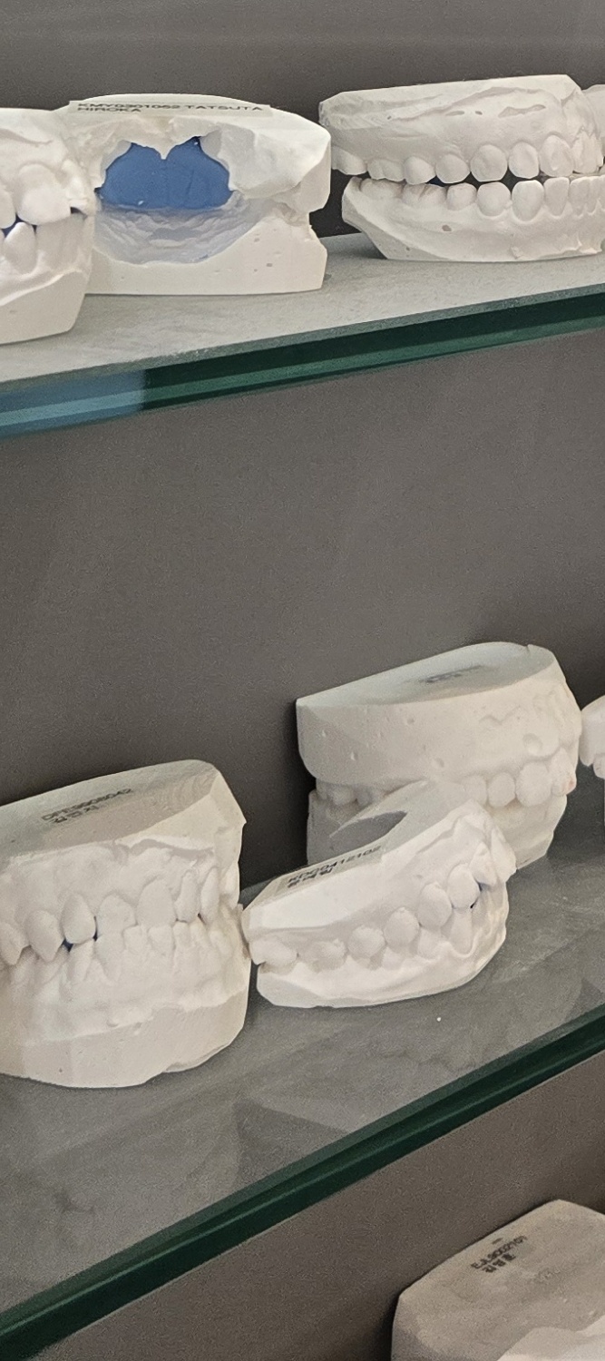 돌출 앞니 교정 이렇게 준비하세요 관련 이미지 30