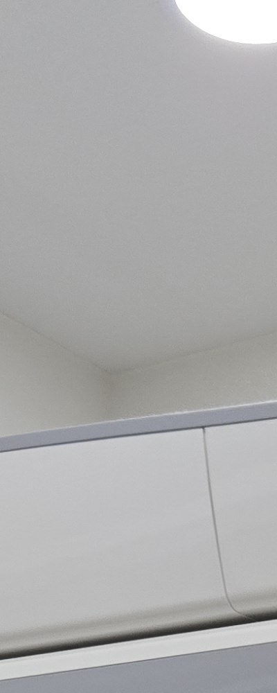 인레이 치료 후 신경치료 이유가 궁금하다면 관련 이미지 17