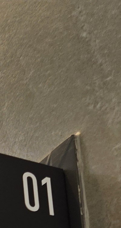 반대교합 치아교정 해결 가능할까 관련 이미지 15