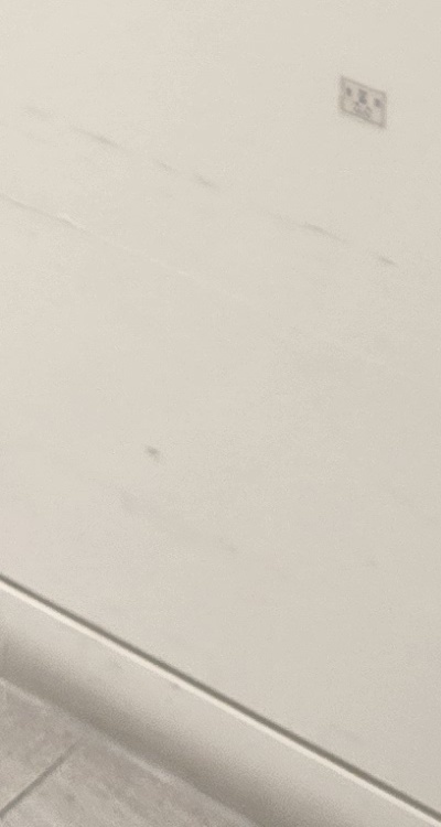 송곳니 크라운 티가 안나게 해결 가능한건가요 관련 이미지 44