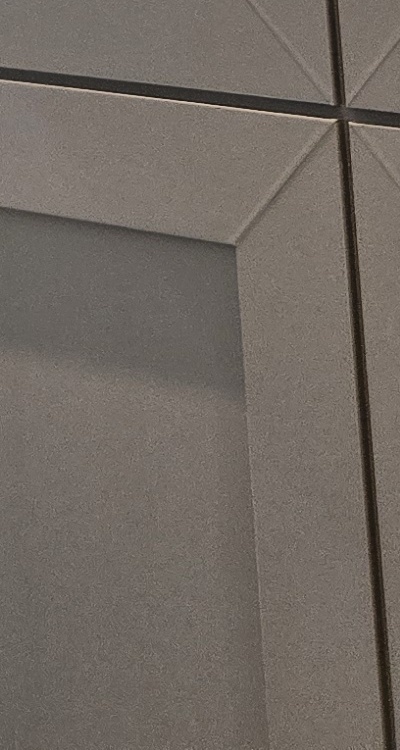 인레이 치료 후 통증 자꾸 심해지는데 괜찮은걸까 관련 이미지 48