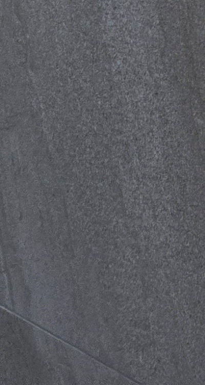 임플란트의 장점 할까 말까 고민이신 분들을 위한 정리 관련 이미지 41