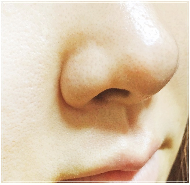 모공수축 쉽게하는방법 관련 이미지 3