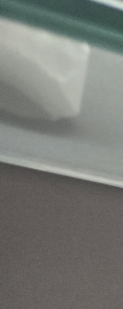 어르신 임플란트 지원 현명하게 활용하려면 관련 이미지 12