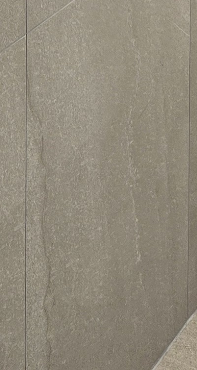 임플란트의 장점 할까 말까 고민이신 분들을 위한 정리 관련 이미지 45