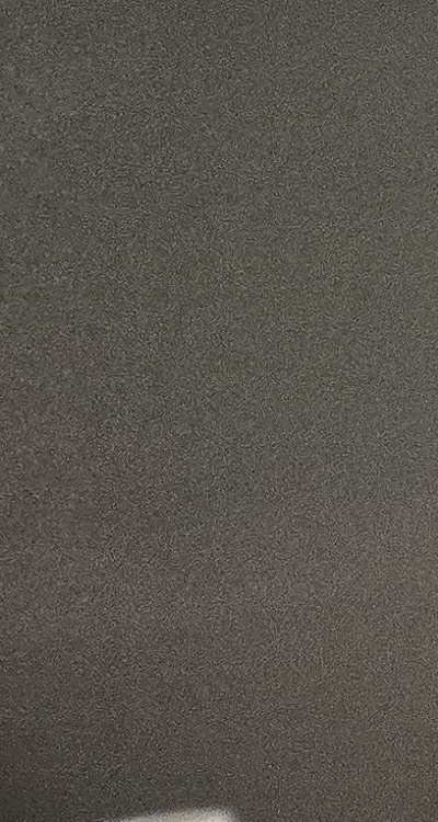 사랑니 주변 잇몸 통증 지금부터가 중요하니까 관련 이미지 32