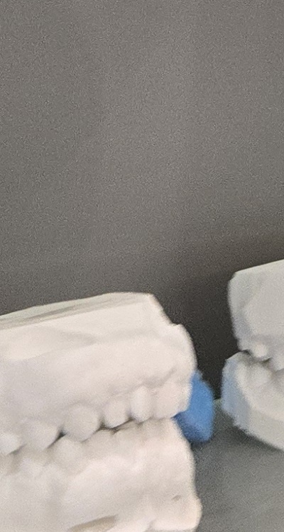 사랑니 주변 잇몸 통증 지금부터가 중요하니까 관련 이미지 36