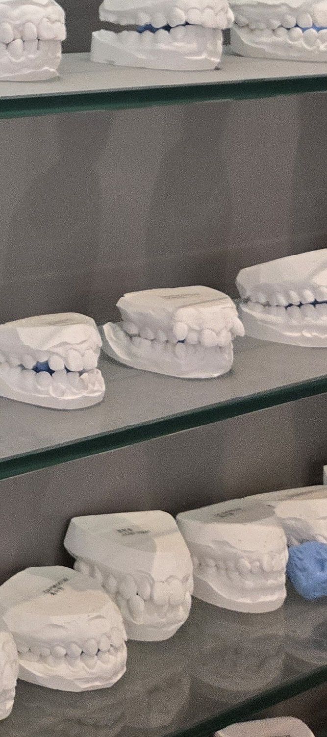 앞니 틀어짐 교정 이렇게 파악하세요 관련 이미지 20