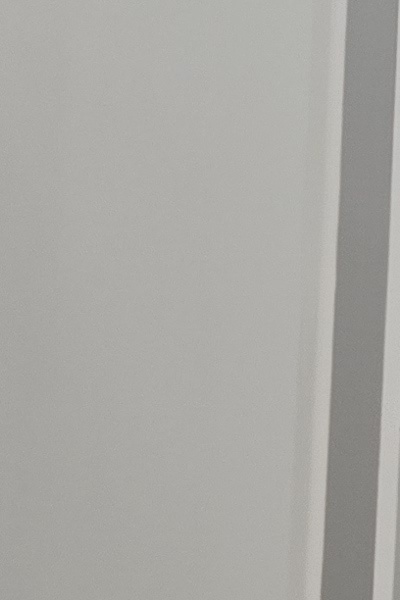 부정교합 교정 안하면 생기는 문제는 뭔가요 관련 이미지 30