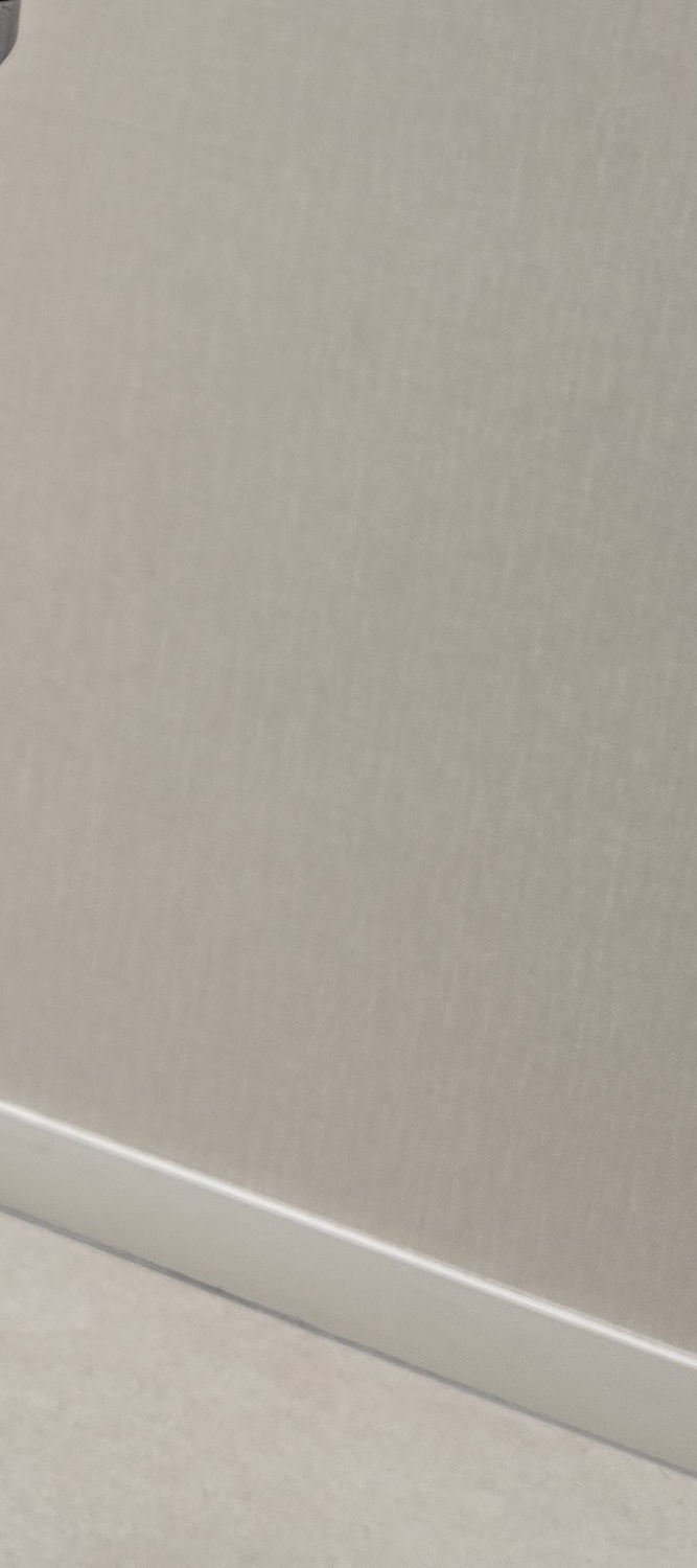 앞니 틀어짐 교정 방법 이럴때는 좀더 간단해요 관련 이미지 19