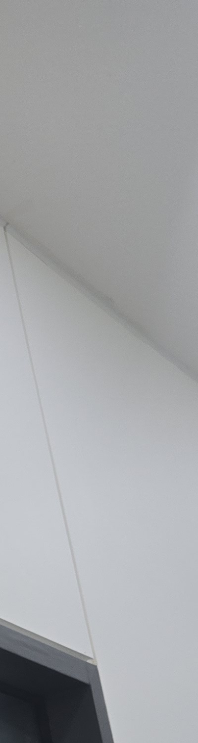 앞니 크라운 교체 깔끔하게 정리하려면 관련 이미지 17