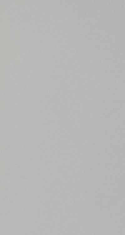 앞니 부분 교정 간단하니까 좋은건가요 관련 이미지 19