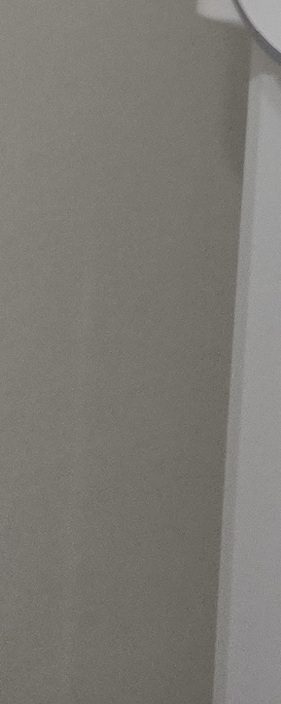 인레이 치료 후 신경치료 이유가 궁금하다면 관련 이미지 34