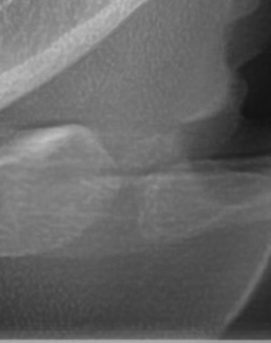 어금니 뒤 잇몸 부음 어떤 문제길래 이런거죠 관련 이미지 46