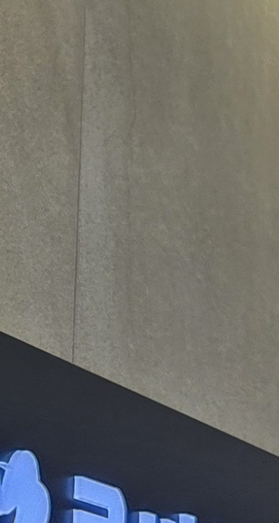 앞니 신경치료 크라운 까지 해야할 상황이라면 관련 이미지 27