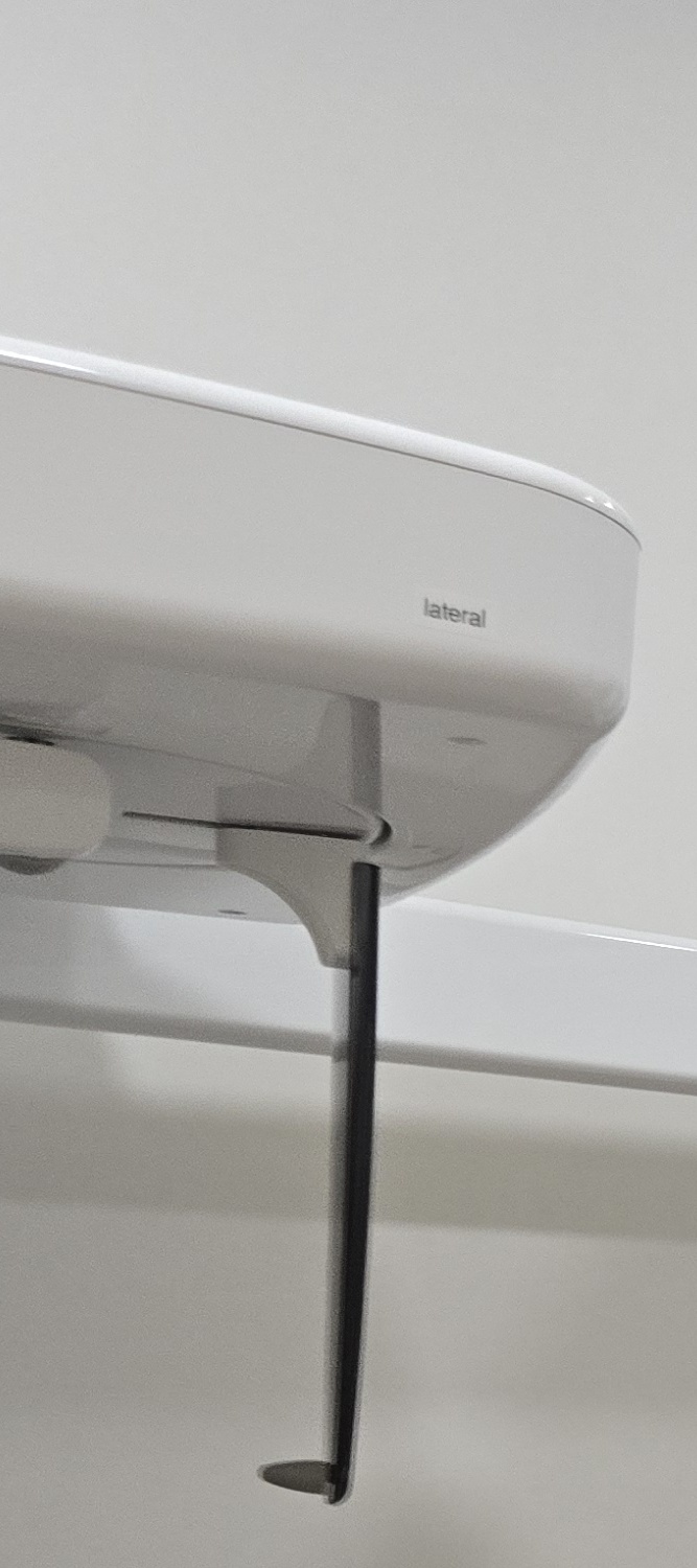 앞니 틀어짐 교정 이렇게 파악하세요 관련 이미지 23