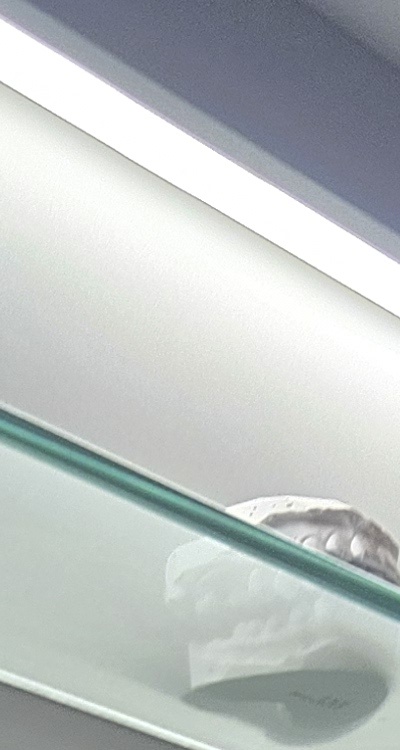 완전매복사랑니 발치 대학병원 꼭 가야하나요 관련 이미지 13