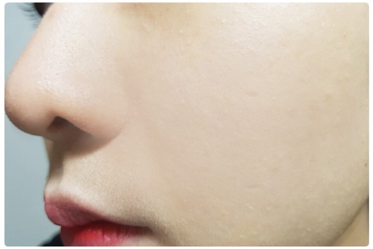 피부트러블 없애버리고 싶다면 관련 이미지 8