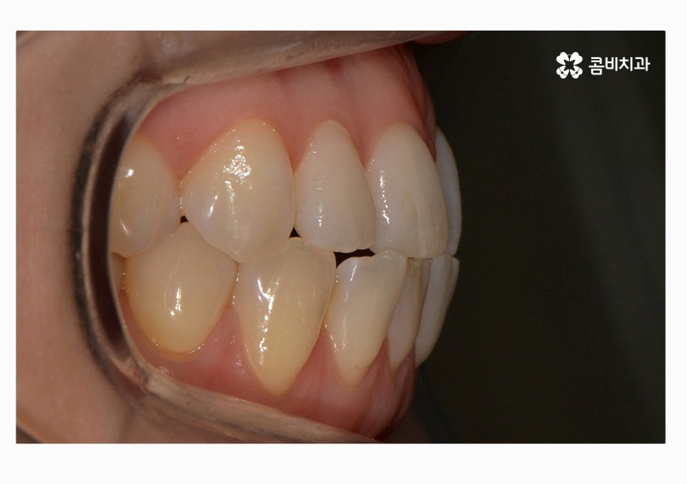 콤비교정 합리적으로 판단하려면 관련 이미지 2