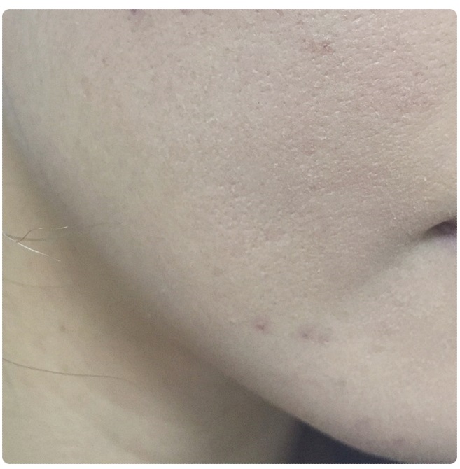 커버력 좋은 파운데이션 추천 피부 고민 해결! 관련 이미지 7