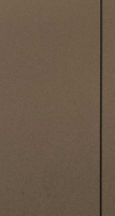 사랑니 발치 후 충치 치료 둘다 준비하려면 관련 이미지 47