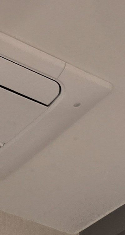 인레이 치료 후 통증 자꾸 심해지는데 괜찮은걸까 관련 이미지 16