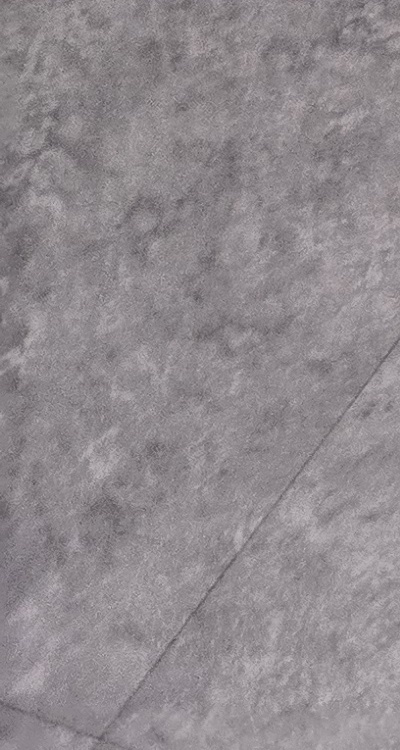 치아 사이 벌어짐 심해지는 이유부터 알아보면 관련 이미지 39