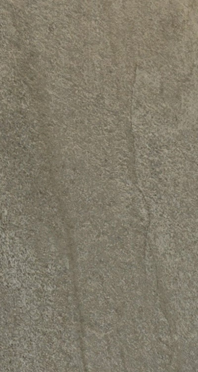 앞니 신경치료 크라운 까지 해야할 상황이라면 관련 이미지 14