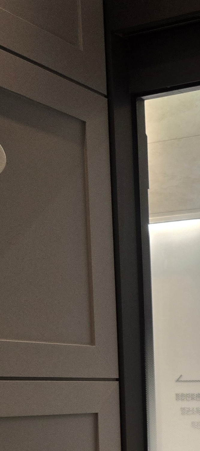 벌어진 앞니 교정 체계적으로 대비하려면 관련 이미지 13