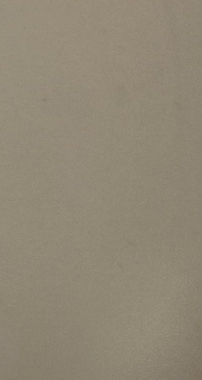 클리피씨교정 장단점 어떻게 비교하면 될까요 관련 이미지 49