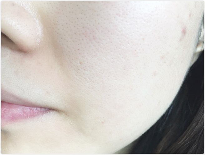 환절기 피부트러블 집에서 간편하게! 관련 이미지 11