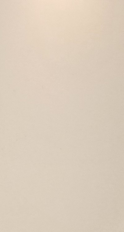 앞니 올세라믹 이건 알고 시작하세요 관련 이미지 15