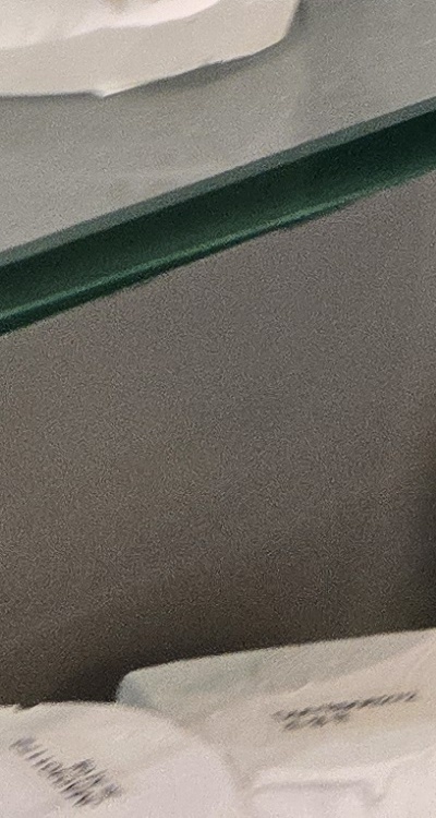 사랑니 주변 잇몸 통증 지금부터가 중요하니까 관련 이미지 46