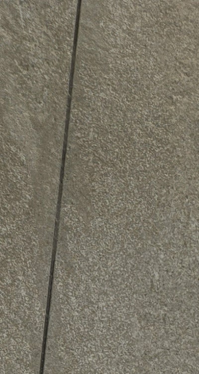 앞니 신경치료 크라운 까지 해야할 상황이라면 관련 이미지 13