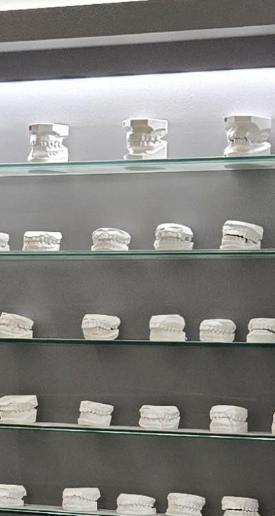 아래 사랑니 발치 통증 미리 알고 대처하려면 관련 이미지 24