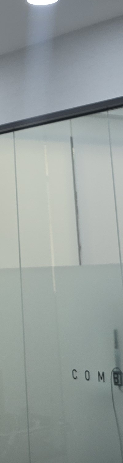 앞니 크라운 교체 깔끔하게 정리하려면 관련 이미지 24