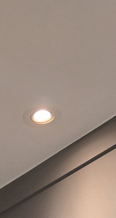 인레이 치료 후 통증 자꾸 심해지는데 괜찮은걸까 관련 이미지 17