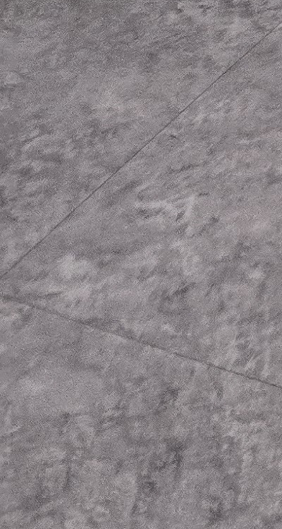 치아 사이 벌어짐 심해지는 이유부터 알아보면 관련 이미지 29