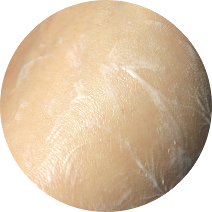 여드름피부화장품 꿀팁을 알려드리자면! 관련 이미지 7