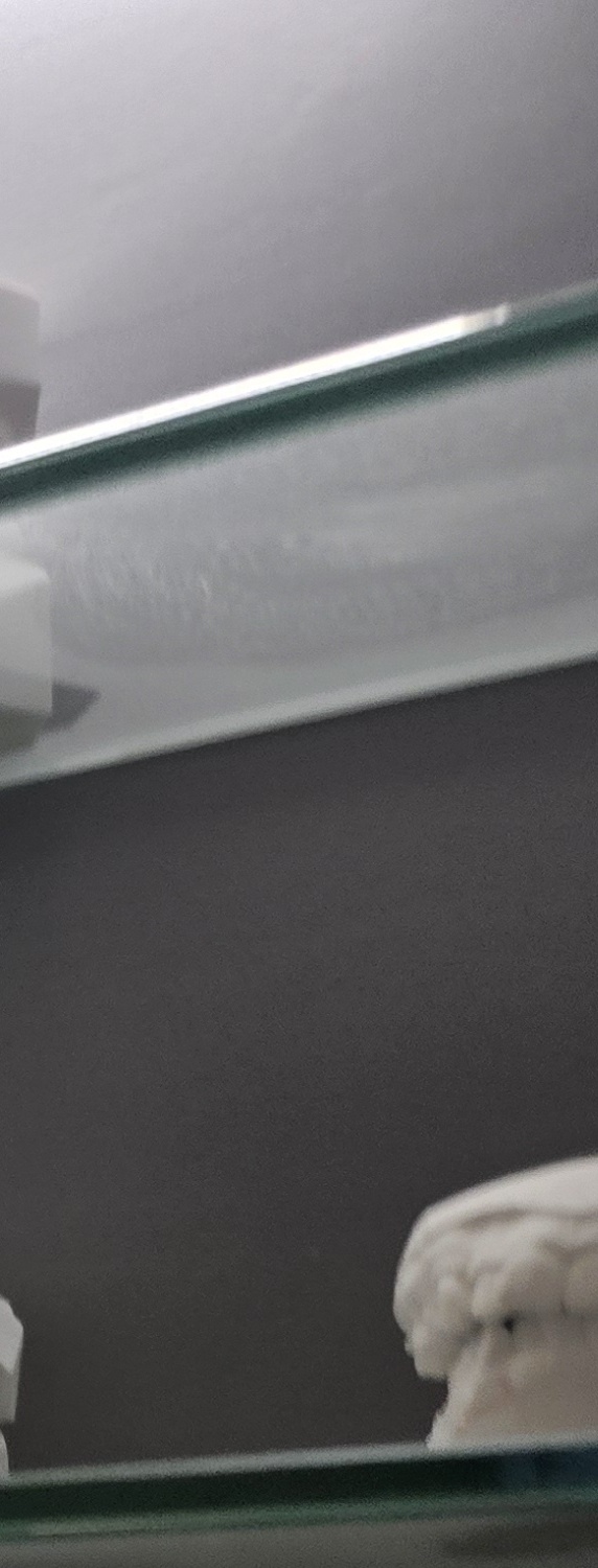 치과 치아미백 효과 어떤식으로 나타날까 관련 이미지 36